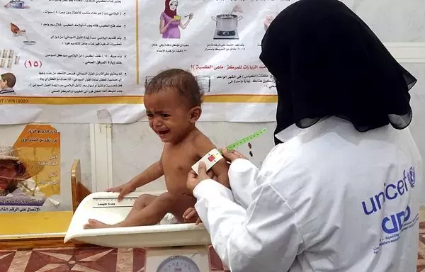 A UN nurse tends to a malnourished child at a treatment center in Yemen's western province of al-Hodeidah on February 15, 2022. [Photo by Khaled Ziad/AFP]